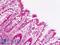 PBK/TOPK antibody, LS-B9068, Lifespan Biosciences, Immunohistochemistry paraffin image 