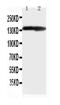 Collagen Type II Alpha 1 Chain antibody, PA2141-1, Boster Biological Technology, Western Blot image 