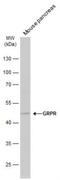 Gastrin Releasing Peptide Receptor antibody, NBP1-30937, Novus Biologicals, Western Blot image 