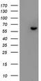 Fyn Related Src Family Tyrosine Kinase antibody, TA501052, Origene, Western Blot image 