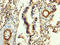 Fibrinogen Beta Chain antibody, LS-C672782, Lifespan Biosciences, Immunohistochemistry paraffin image 
