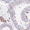 Transmembrane Protein 106B antibody, NBP2-31714, Novus Biologicals, Immunohistochemistry paraffin image 