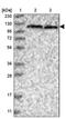 Mtr4 Exosome RNA Helicase antibody, PA5-57927, Invitrogen Antibodies, Western Blot image 