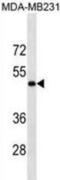 Lysyl Oxidase antibody, abx025524, Abbexa, Western Blot image 