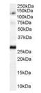 Importin 7 antibody, orb18785, Biorbyt, Western Blot image 