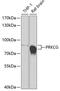 Protein Kinase C Gamma antibody, GTX55750, GeneTex, Western Blot image 