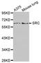 SRC Proto-Oncogene, Non-Receptor Tyrosine Kinase antibody, STJ25689, St John