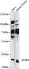 Potassium Two Pore Domain Channel Subfamily K Member 3 antibody, 15-701, ProSci, Western Blot image 