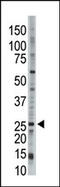 Ubiquitin Conjugating Enzyme E2 E3 antibody, 61-126, ProSci, Western Blot image 