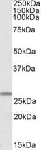 Coiled-Coil-Helix-Coiled-Coil-Helix Domain Containing 3 antibody, NBP1-52008, Novus Biologicals, Western Blot image 