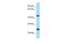 Type I inositol-1,4,5-trisphosphate 5-phosphatase antibody, PA5-45906, Invitrogen Antibodies, Western Blot image 