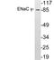 Sodium Channel Epithelial 1 Gamma Subunit antibody, LS-C199843, Lifespan Biosciences, Western Blot image 