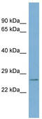 WW Domain Binding Protein 2 antibody, TA334464, Origene, Western Blot image 