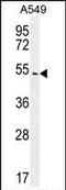 Arrestin Beta 1 antibody, PA5-35089, Invitrogen Antibodies, Western Blot image 