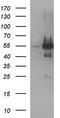 Ankyrin repeat and MYND domain-containing protein 2 antibody, LS-C788558, Lifespan Biosciences, Western Blot image 