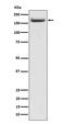 Insulin Receptor Substrate 2 antibody, M00805, Boster Biological Technology, Western Blot image 