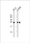 Zinc Finger CCHC-Type Containing 17 antibody, PA5-48118, Invitrogen Antibodies, Western Blot image 