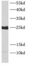 ADP Ribosylation Factor Like GTPase 4C antibody, FNab00578, FineTest, Western Blot image 
