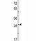 ZFP36 Ring Finger Protein antibody, F51446-0.4ML, NSJ Bioreagents, Western Blot image 