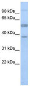 Lymphocyte-specific protein 1 antibody, TA330314, Origene, Western Blot image 