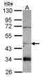 Carnosine Dipeptidase 2 antibody, NBP2-15926, Novus Biologicals, Western Blot image 