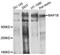 Microtubule Associated Protein 1B antibody, STJ24455, St John