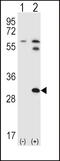 Signal Transducing Adaptor Family Member 1 antibody, 57-968, ProSci, Western Blot image 