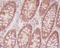 CD46 Molecule antibody, M00377-1, Boster Biological Technology, Immunohistochemistry paraffin image 