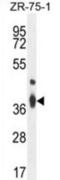 Transmembrane BAX Inhibitor Motif Containing 4 antibody, abx025741, Abbexa, Western Blot image 