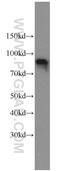 Oligophrenin 1 antibody, 11076-1-AP, Proteintech Group, Western Blot image 