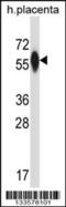 Prolyl 4-Hydroxylase Subunit Alpha 3 antibody, 57-200, ProSci, Western Blot image 
