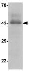 C-C Motif Chemokine Receptor 7 antibody, GTX31906, GeneTex, Western Blot image 