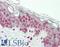 Nuclear Receptor Subfamily 3 Group C Member 1 antibody, LS-B12900, Lifespan Biosciences, Immunohistochemistry paraffin image 