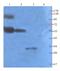 Claudin 5 antibody, GTX37283, GeneTex, Western Blot image 