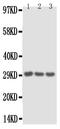 Interleukin-1 alpha antibody, PA1375, Boster Biological Technology, Western Blot image 