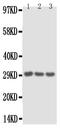 Interleukin 1 Alpha antibody, PA1375, Boster Biological Technology, Western Blot image 