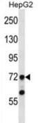 TATA-Box Binding Protein Associated Factor 6 antibody, abx028166, Abbexa, Western Blot image 