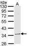 General Transcription Factor IIB antibody, PA5-29812, Invitrogen Antibodies, Western Blot image 