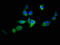 Autophagy Related 2B antibody, LS-C378226, Lifespan Biosciences, Immunofluorescence image 