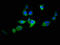 Autophagy Related 2B antibody, LS-C378226, Lifespan Biosciences, Immunofluorescence image 