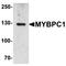 Myosin Binding Protein C, Slow Type antibody, orb75724, Biorbyt, Western Blot image 