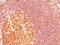 MALT1 Paracaspase antibody, NBP2-44348, Novus Biologicals, Immunohistochemistry paraffin image 