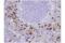 S100 Calcium Binding Protein A9 antibody, 73425S, Cell Signaling Technology, Immunohistochemistry paraffin image 