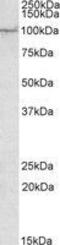 AP2 Associated Kinase 1 antibody, GTX88323, GeneTex, Western Blot image 