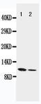 Resistin antibody, LS-C312634, Lifespan Biosciences, Western Blot image 