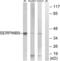 Serpin Family B Member 9 antibody, LS-C120383, Lifespan Biosciences, Western Blot image 