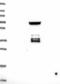 Caseinolytic Mitochondrial Matrix Peptidase Chaperone Subunit antibody, NBP1-89478, Novus Biologicals, Western Blot image 