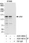 ABL Proto-Oncogene 1, Non-Receptor Tyrosine Kinase antibody, A301-661A, Bethyl Labs, Immunoprecipitation image 