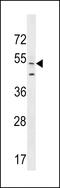 ArfGAP With FG Repeats 2 antibody, 59-494, ProSci, Western Blot image 