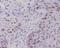 c-Myc antibody, M00026-1, Boster Biological Technology, Immunohistochemistry paraffin image 